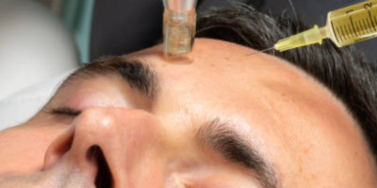 Is Microneedling With PRP Helpful for a Tired-Looking Complexion?