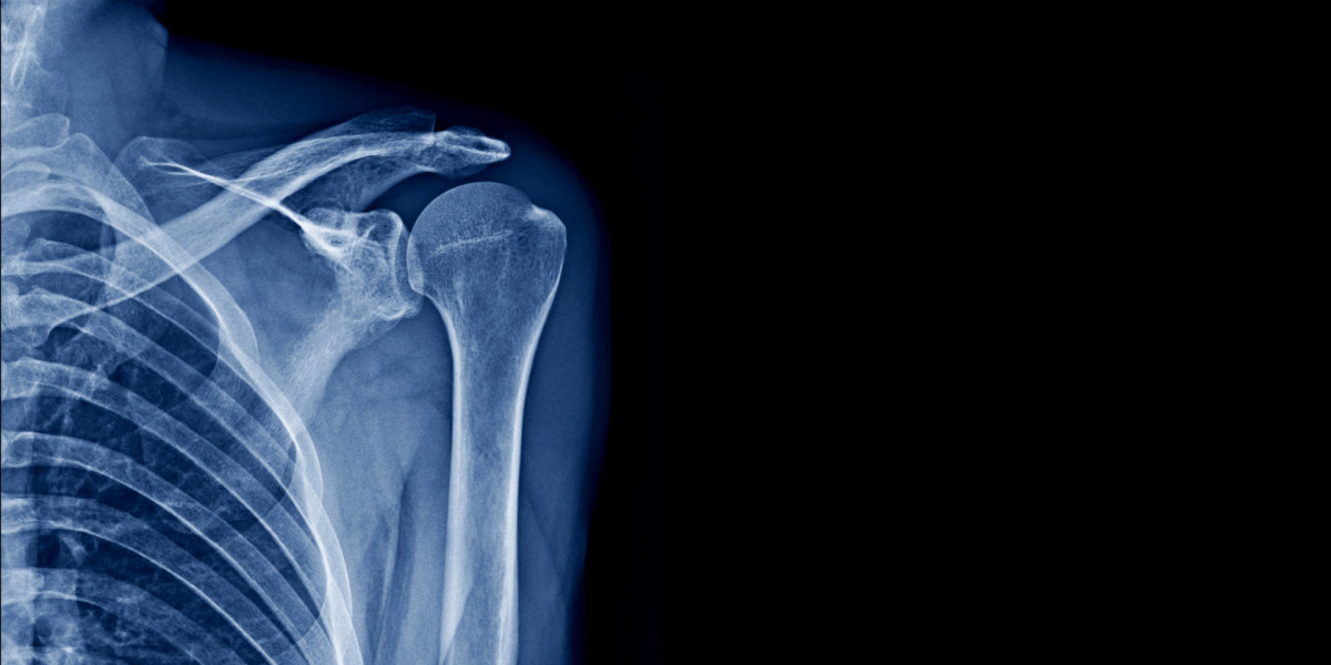 Soft Tissue Injuries That Don’t Show on Scans